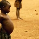 One disease on the rise is kwashiorkor, which causes the swollen _bellies familiar in reports from famine-stricken countries.